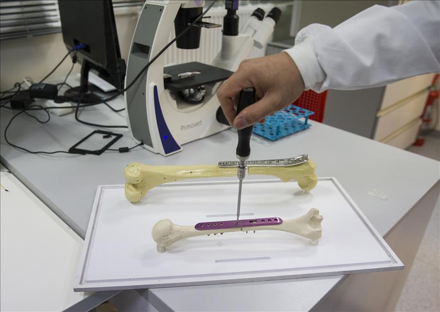 طبيب تركي يحصل على براءة اختراع عن آلية لتطويل العظام
