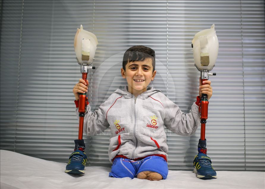 Suriye'nin yaralı çocukları protez bacaklarıyla umuda koşuyor
