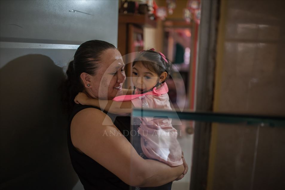 Generación del Zika, Microcefalia