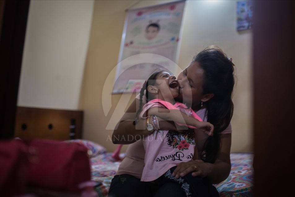 Generación del Zika, Microcefalia