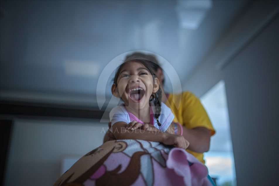 Generación del Zika, Microcefalia