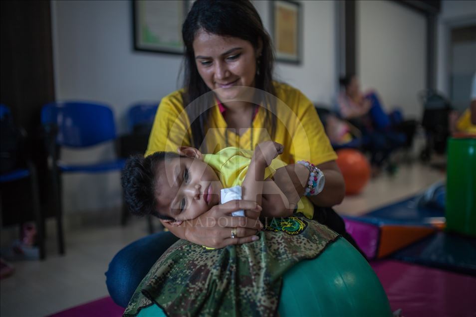 Generation of Zika, Microcephaly