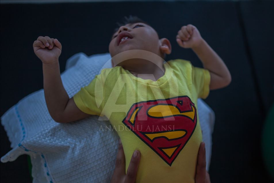 Generation of Zika, Microcephaly
