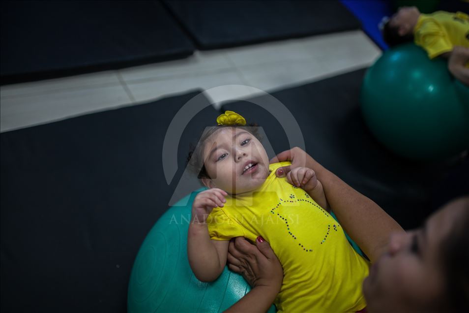 Generation of Zika, Microcephaly