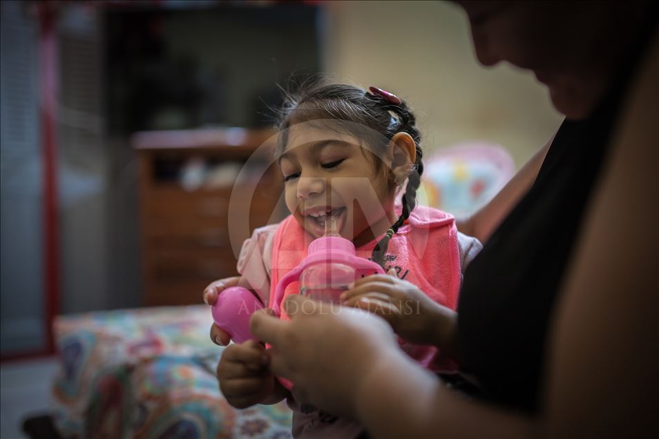 Generation of Zika, Microcephaly