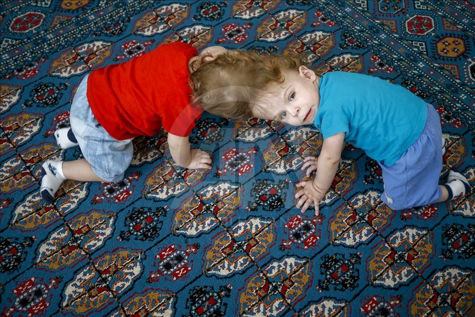 تركيا.. التوأمان السياميان "ديرمان" و"ييغيت" يكملان عامهما الأول