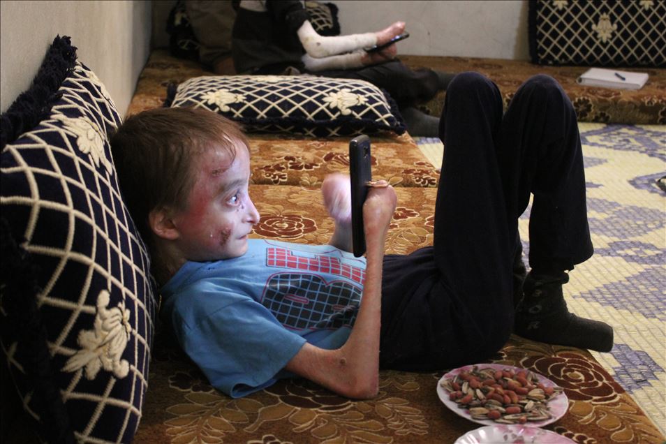 شابان سوريان بريف إدلب.. مرض نادر فاقمه قصف النظام