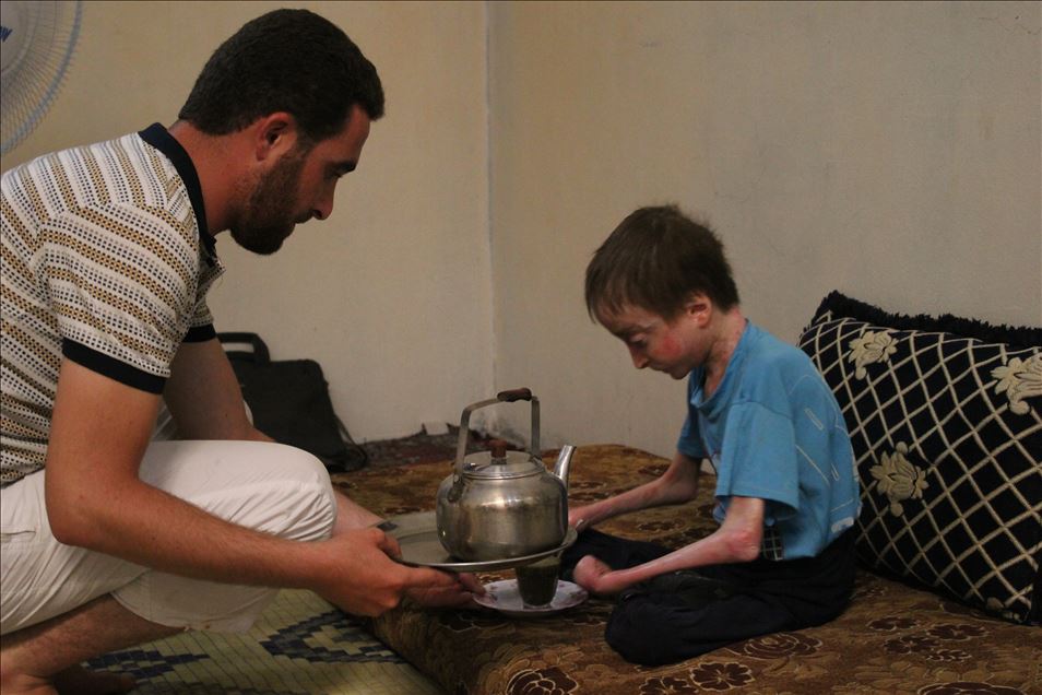 شابان سوريان بريف إدلب.. مرض نادر فاقمه قصف النظام