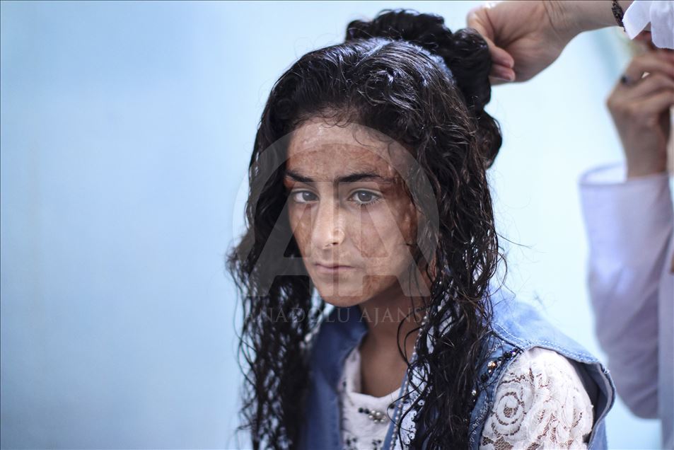 Suriye'de "Hem Saçlara Hem Kalplere Örgü" projesi