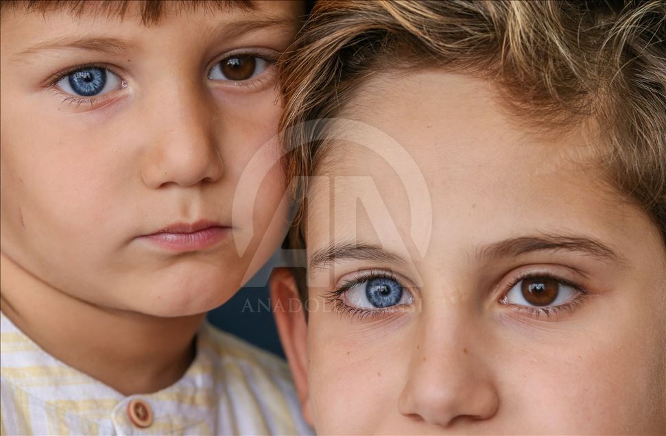 Turqi, vëllezërit me ngjyra të veçanta të syve tërheqin vëmendjen e njerëzve
