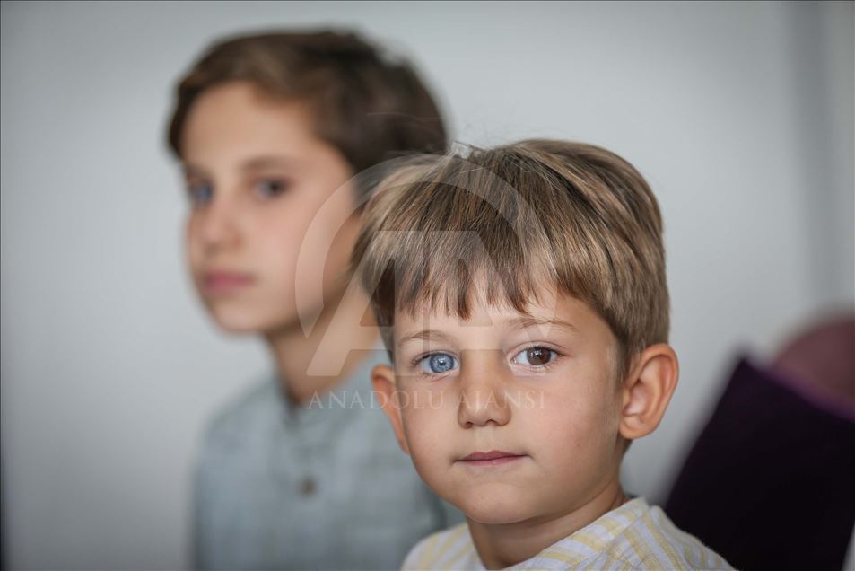 Turquía: Hermanos con raro color de ojos llaman la atención