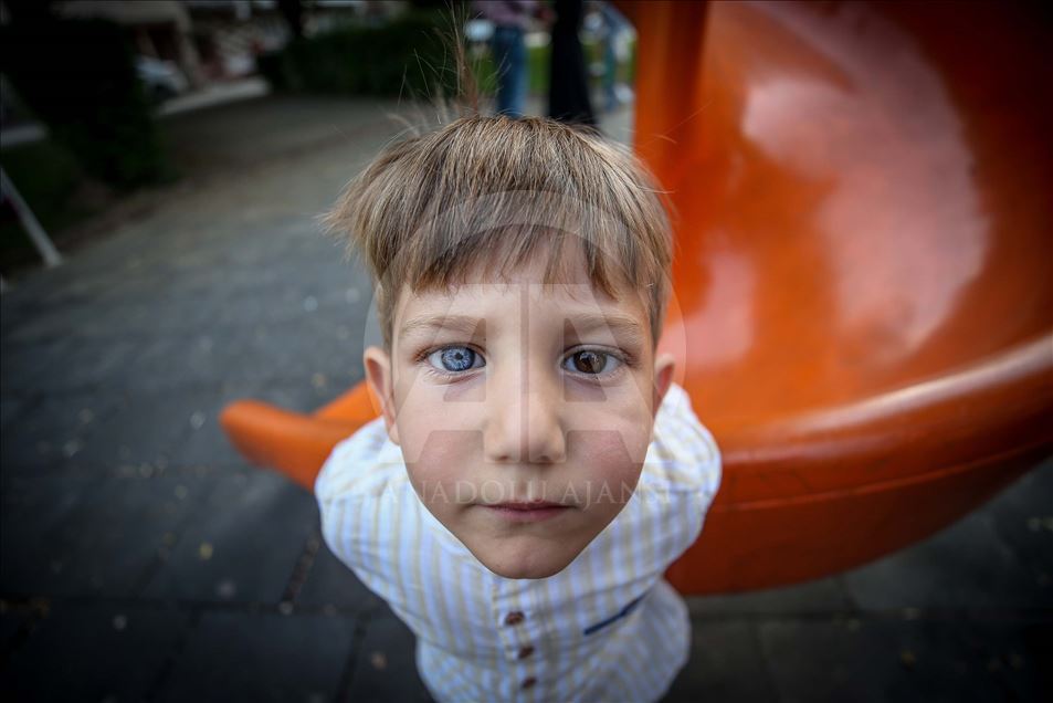 Turquía: Hermanos con raro color de ojos llaman la atención