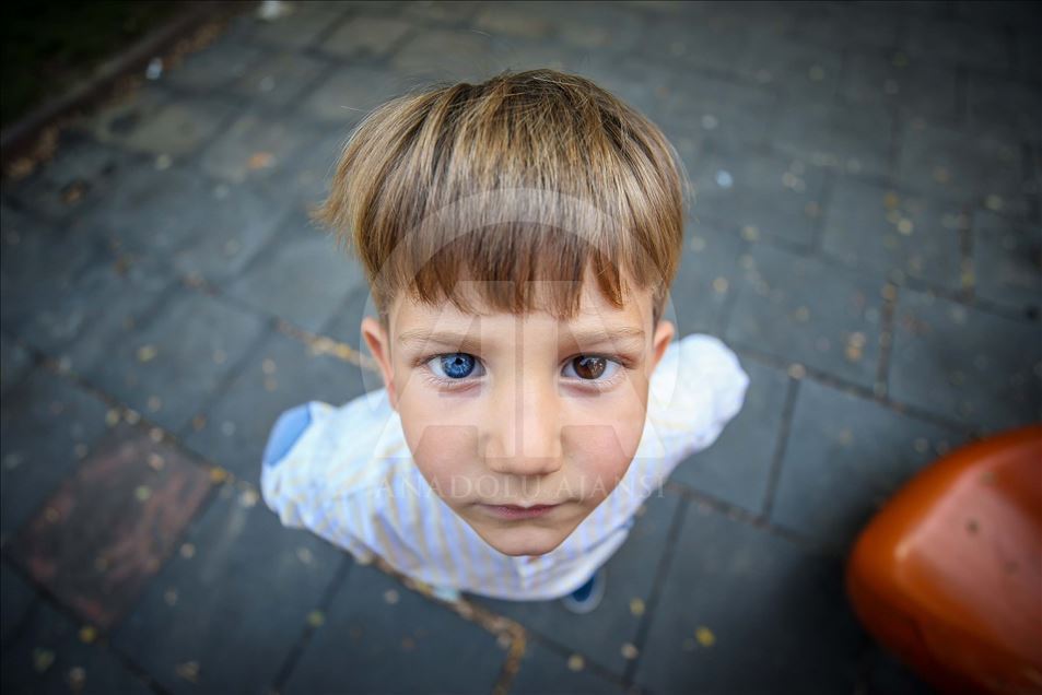 Turquía: Hermanos con raro color de ojos llaman la atención