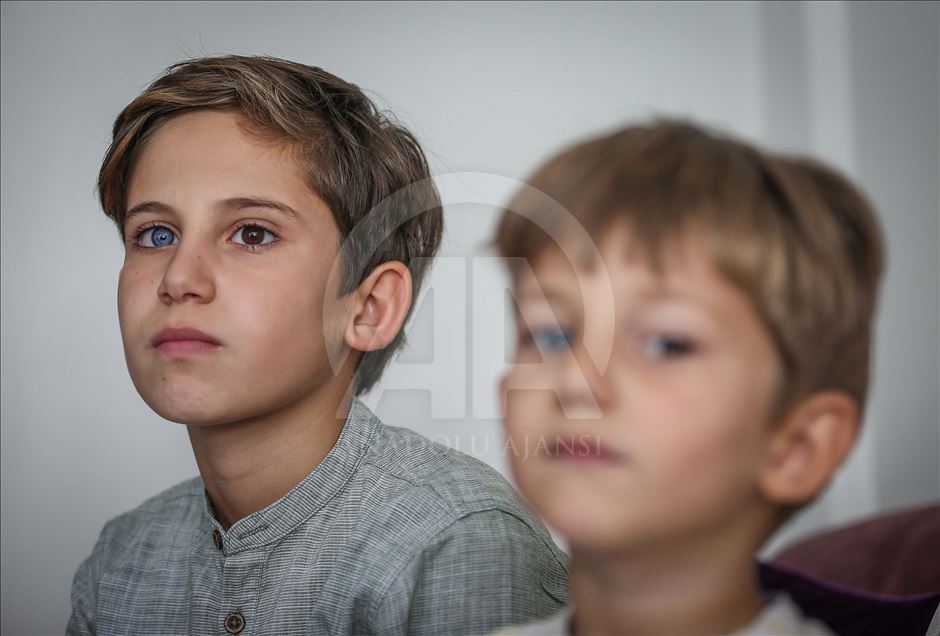 Turquía: Hermanos con raro color de ojos llaman la atención