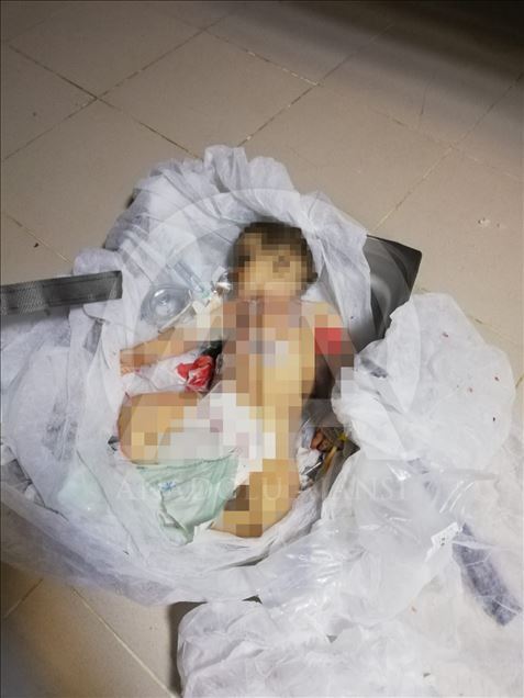 9 aylık Muhammed bebek YPG/PKK'nın kurbanı oldu