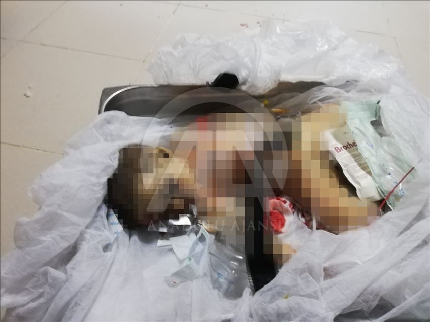 9-month-old baby boy victim of PKK/YPG terrorists