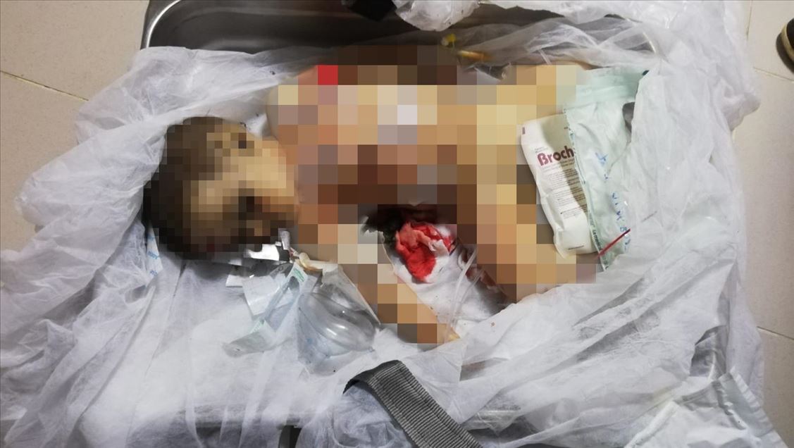 9-month-old baby boy victim of PKK/YPG terrorists
