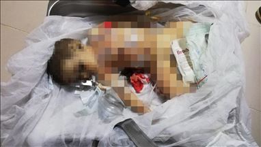 9-month-old baby boy victim of PKK/YPG terrorists