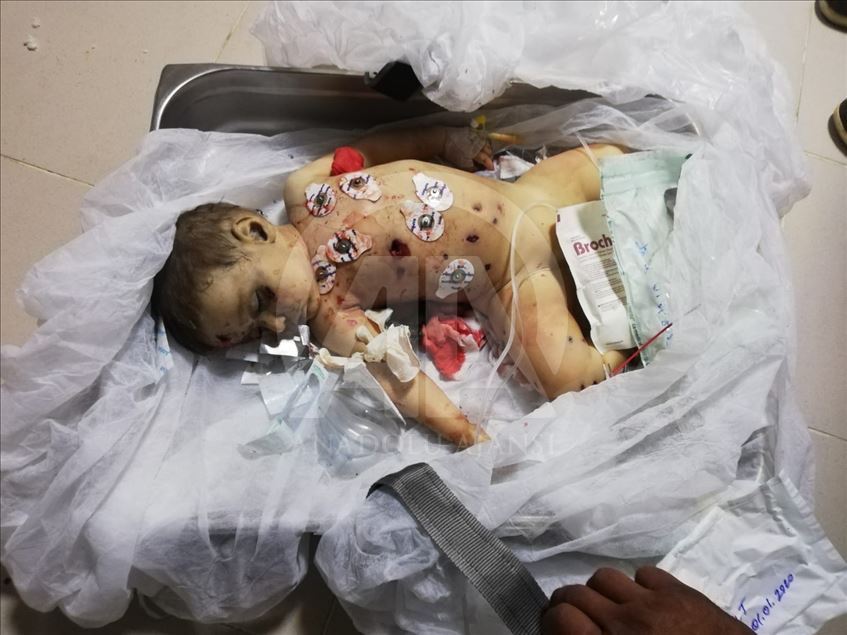 نوزاد 9 ماهه در حمله گروه تروریستی ی.پ.گ/ پ.ک.ک شهید شد