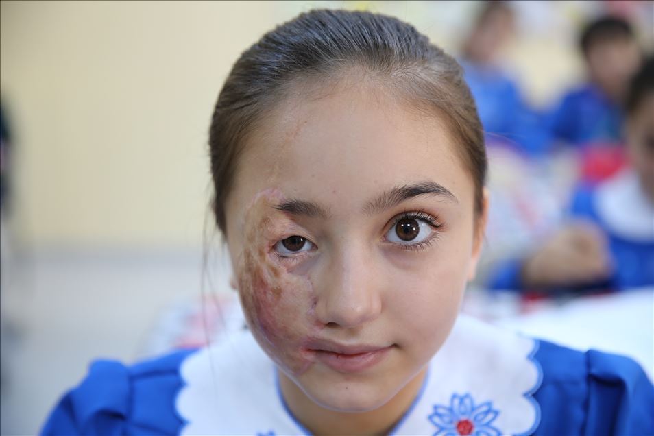Suriye'deki iç savaşın yetim bıraktığı kız çocukları
