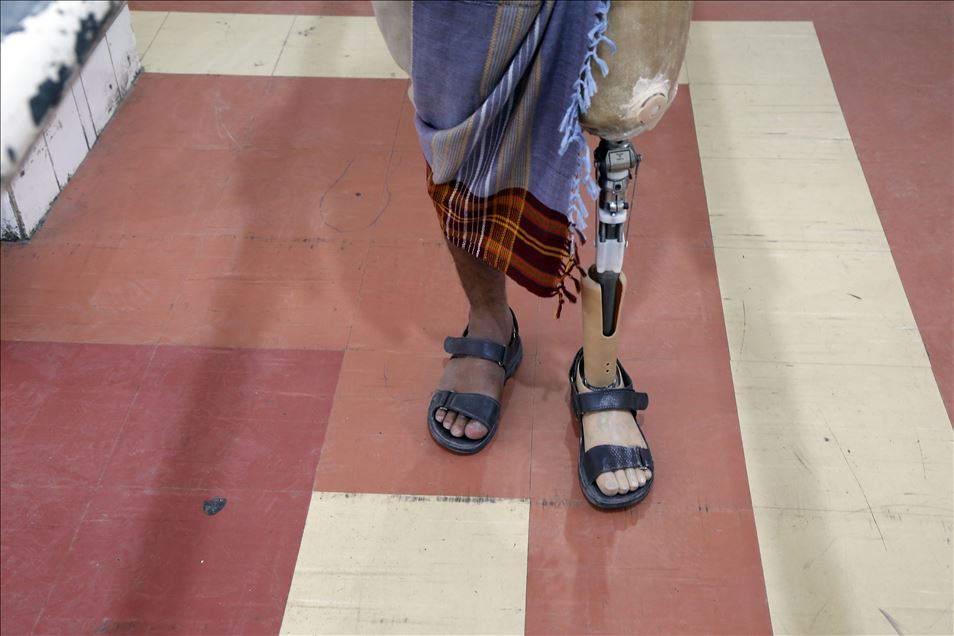Yemen'deki iç savaş mağdurları protezle hayata tutunuyor