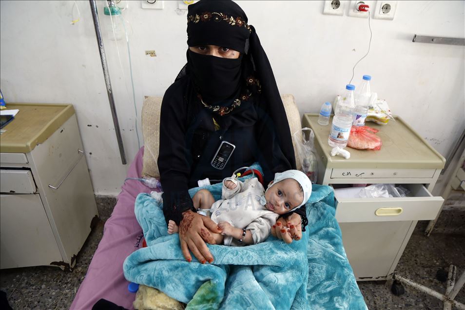 Humanitarian crisis increases day by day in Yemen
