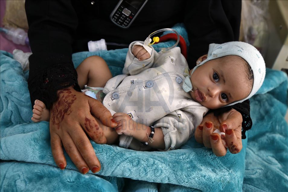 Humanitarian crisis increases day by day in Yemen