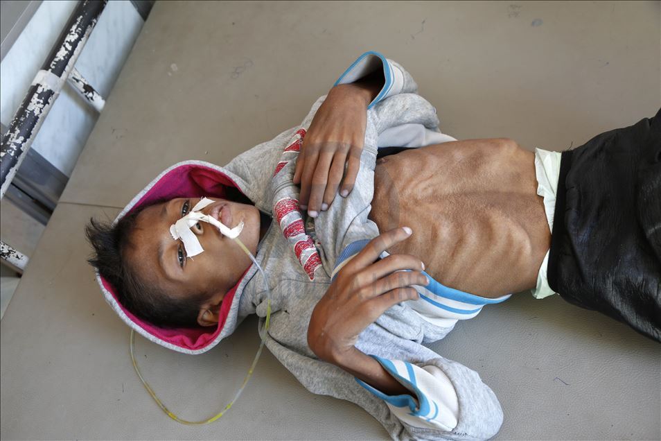 Humanitarian crisis increases day by day in Yemen