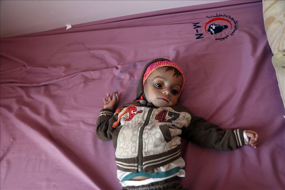 Humanitarian crisis increases day by day in Yemen