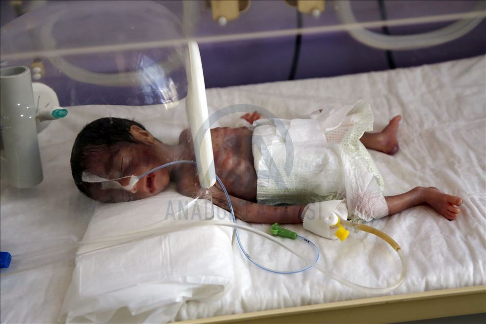 Humanitarian crisis increases day by day in Yemen