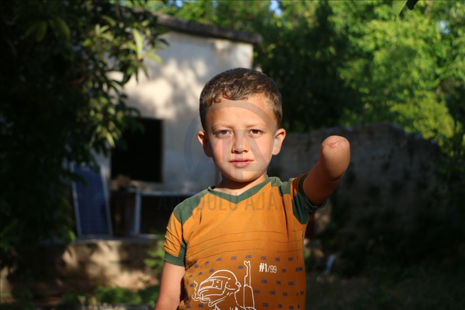 زخم داغ جنگ داخلی بر پیشانی کودکان سوری