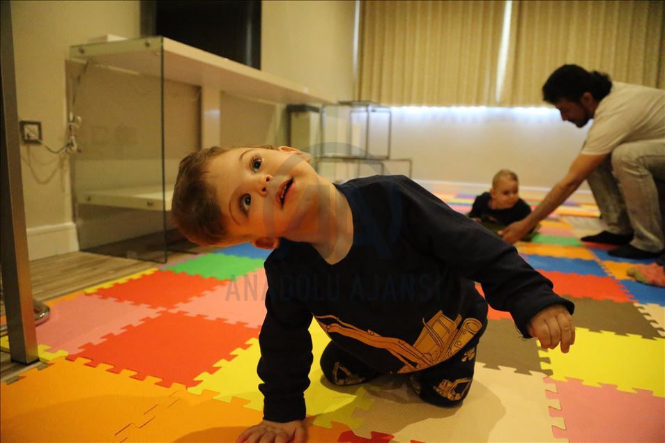 Conjoined Turkish twins find new life after surgery abroad