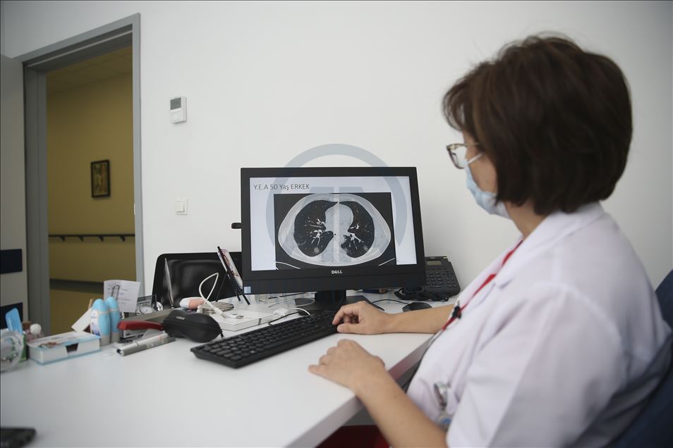 Koronavirüsün akciğerdeki ağır tahribatı, hastaların tomografi görüntülerine yansıdı