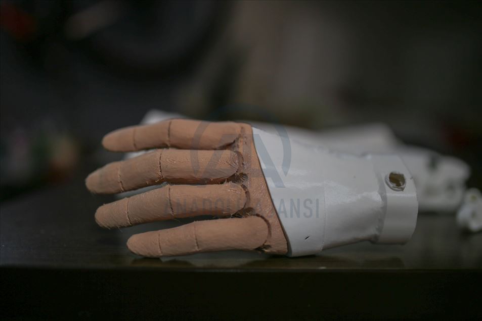 Empresa en Colombia utiliza impresoras 3D para crear prótesis con diseños de superhéroes para niños discapacitados