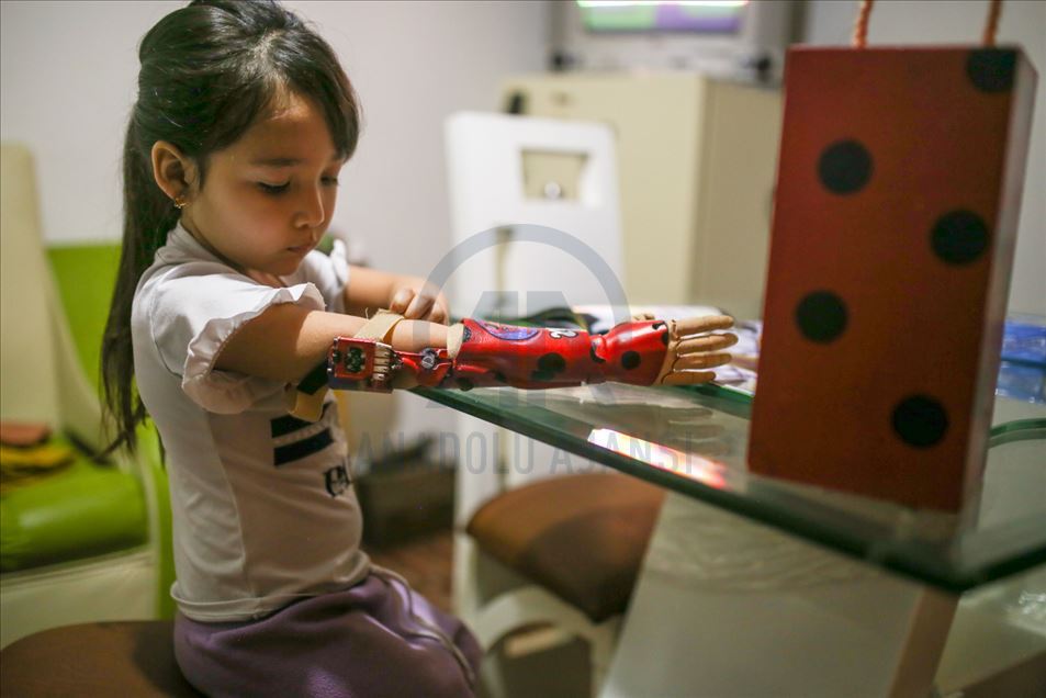 Empresa en Colombia utiliza impresoras 3D para crear prótesis con diseños de superhéroes para niños discapacitados