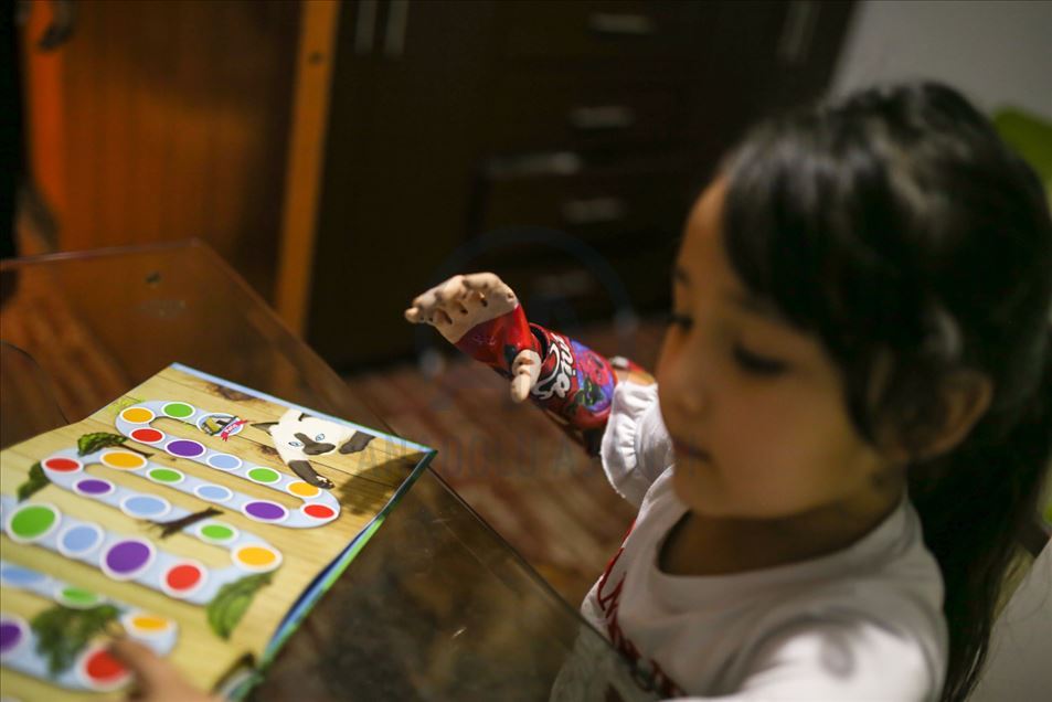Empresa en Colombia utiliza impresoras 3D para crear prótesis con diseños de superhéroes para niños discapacitados
