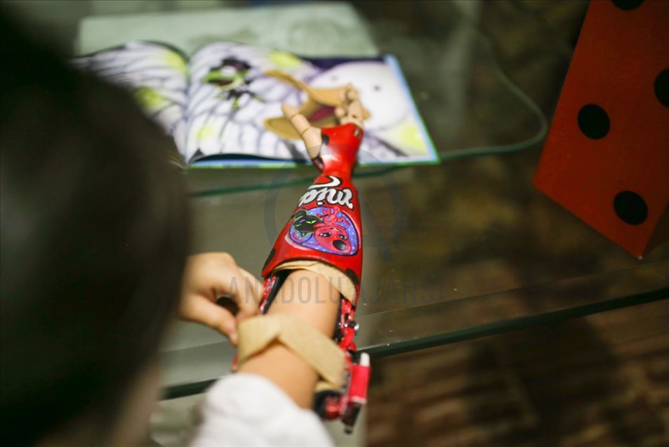 Empresa en Colombia utiliza impresoras 3D para crear prótesis con diseños de superhéroes para niños discapacitados