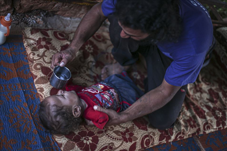 Doğuştan ayak ve kolları olmayan Muhammed bebek, İdlib'de yaşam mücadelesi veriyor
