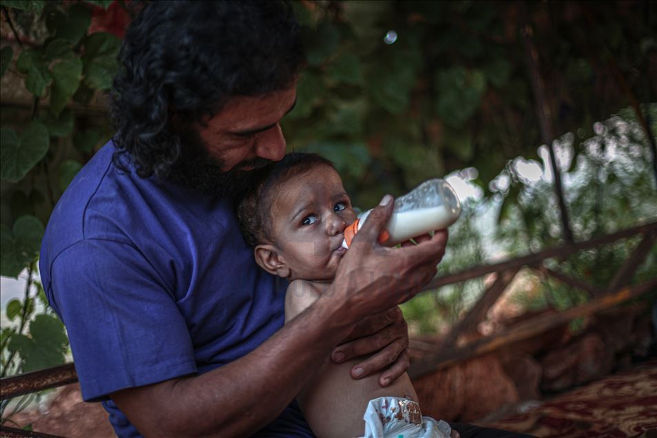 Doğuştan ayak ve kolları olmayan Muhammed bebek, İdlib'de yaşam mücadelesi veriyor
