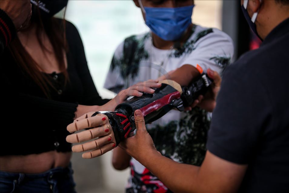 Colombia: Empresa utiliza la impresión 3D para ayudar a un joven indígena discapacitado que perdió sus extremidades