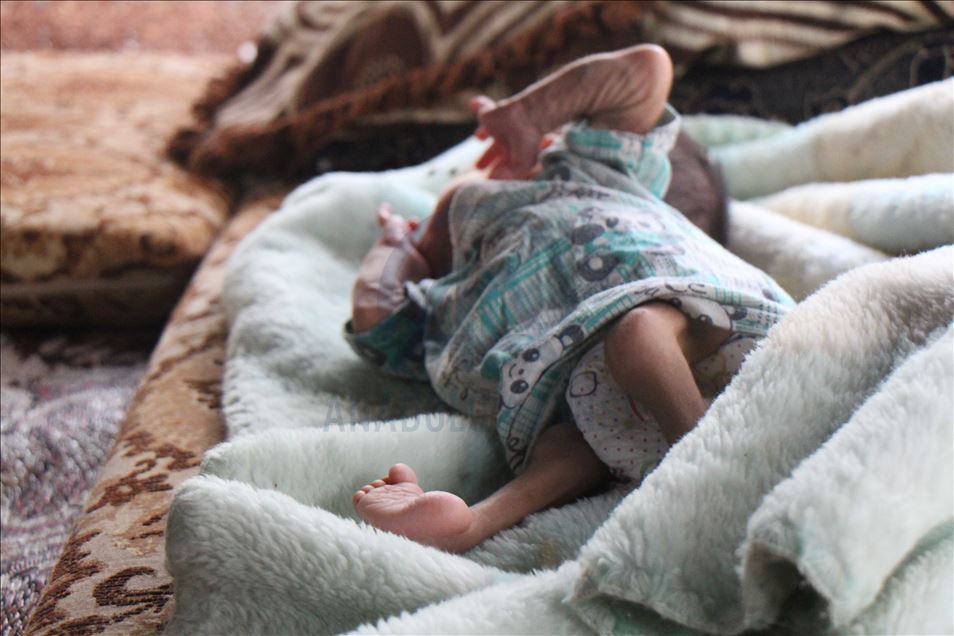 تنتظر الرضيعة السورية النازحة "نور"