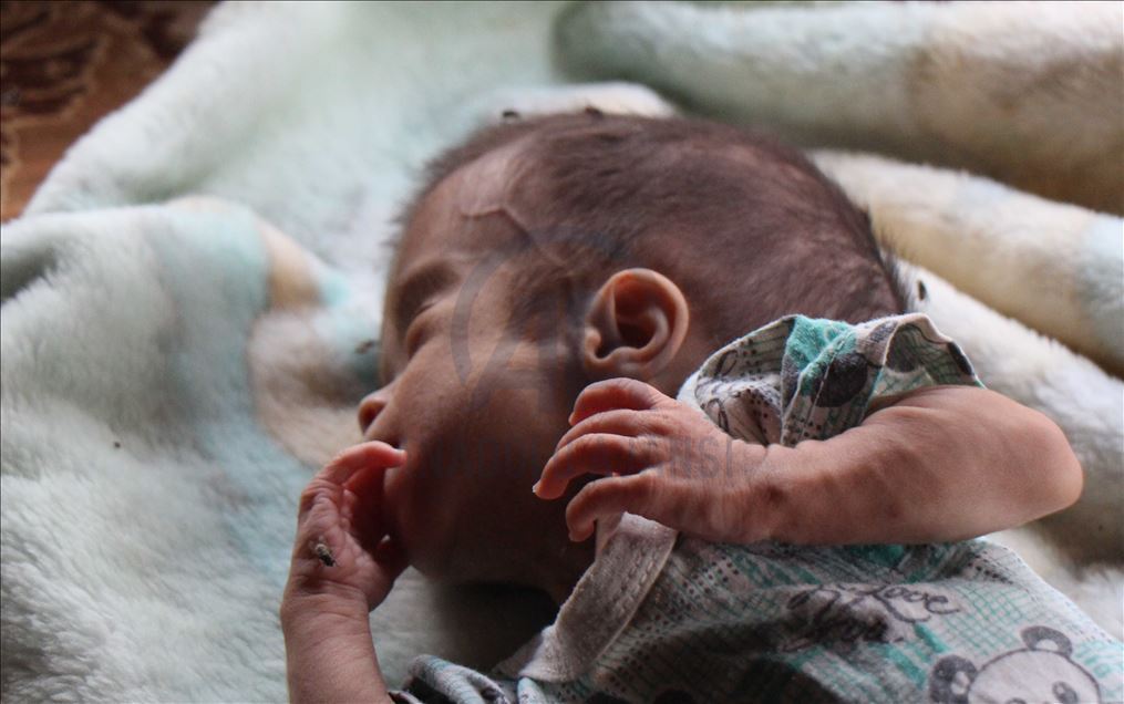 تنتظر الرضيعة السورية النازحة "نور"