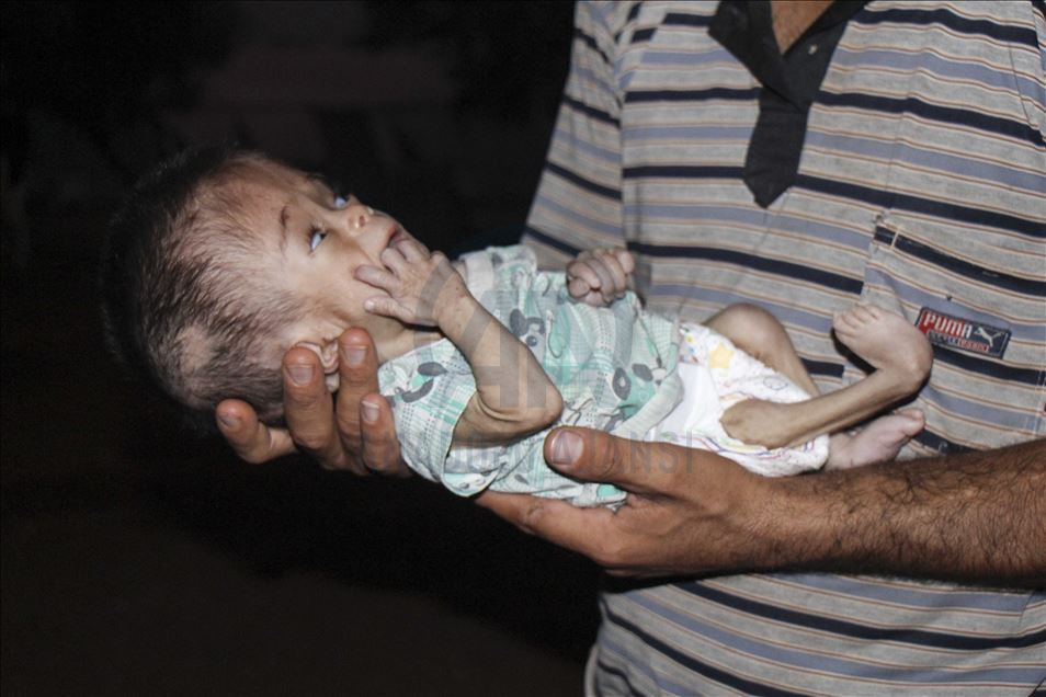 تنتظر الرضيعة السورية النازحة "نور"