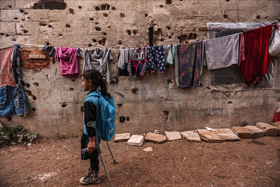 للذهاب لمدرستها.. طفلة سورية تحلم بطرف اصطناعي