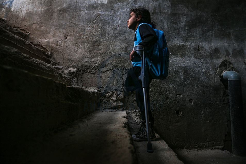 للذهاب لمدرستها.. طفلة سورية تحلم بطرف اصطناعي