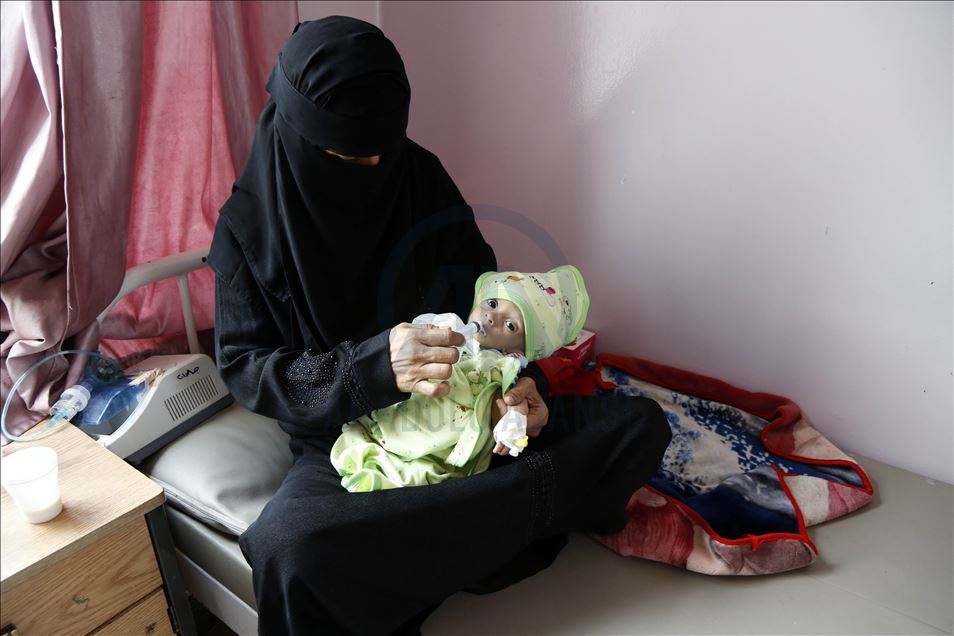 Yeryüzü Doktorları, Yemen'deki en büyük sorunun açlık krizi olduğunu açıkladı