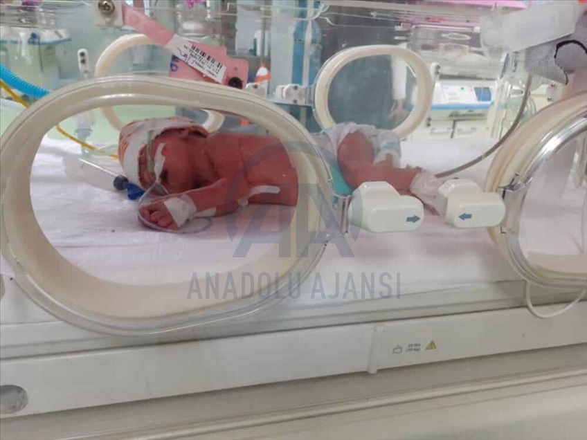 في ظاهرة نادرة.. إمرأة تركية برحمين تنجب توأما