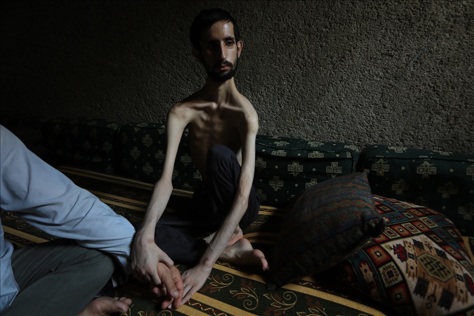 Injured, homeless Syrian youth still awaits help