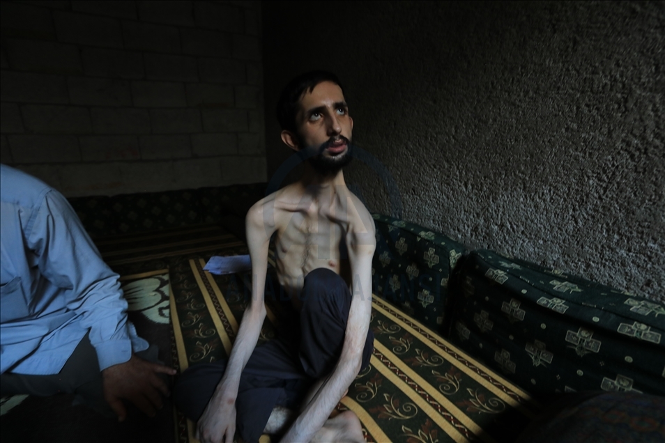 Korban rezim Assad menunggu bantuan
