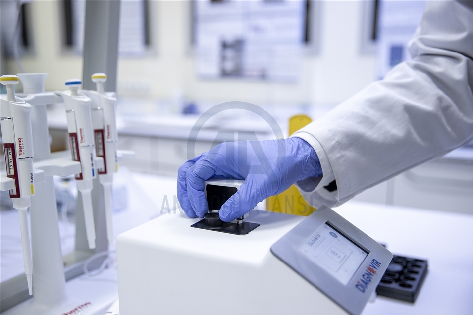 Türk bilim insanları, koronavirüs teşhisini 10 saniyeye düşüren, PCR'ın yerini almaya aday tanı sistemi geliştirdi